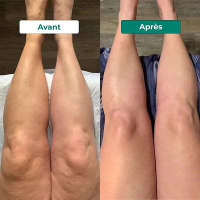 Drainage Lymphatique Liquide – Visage Affiné, Jambes Légères, Ventre Plat
