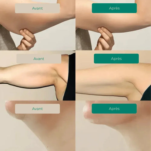 Drainage Lymphatique Liquide – Visage Affiné, Jambes Légères, Ventre Plat