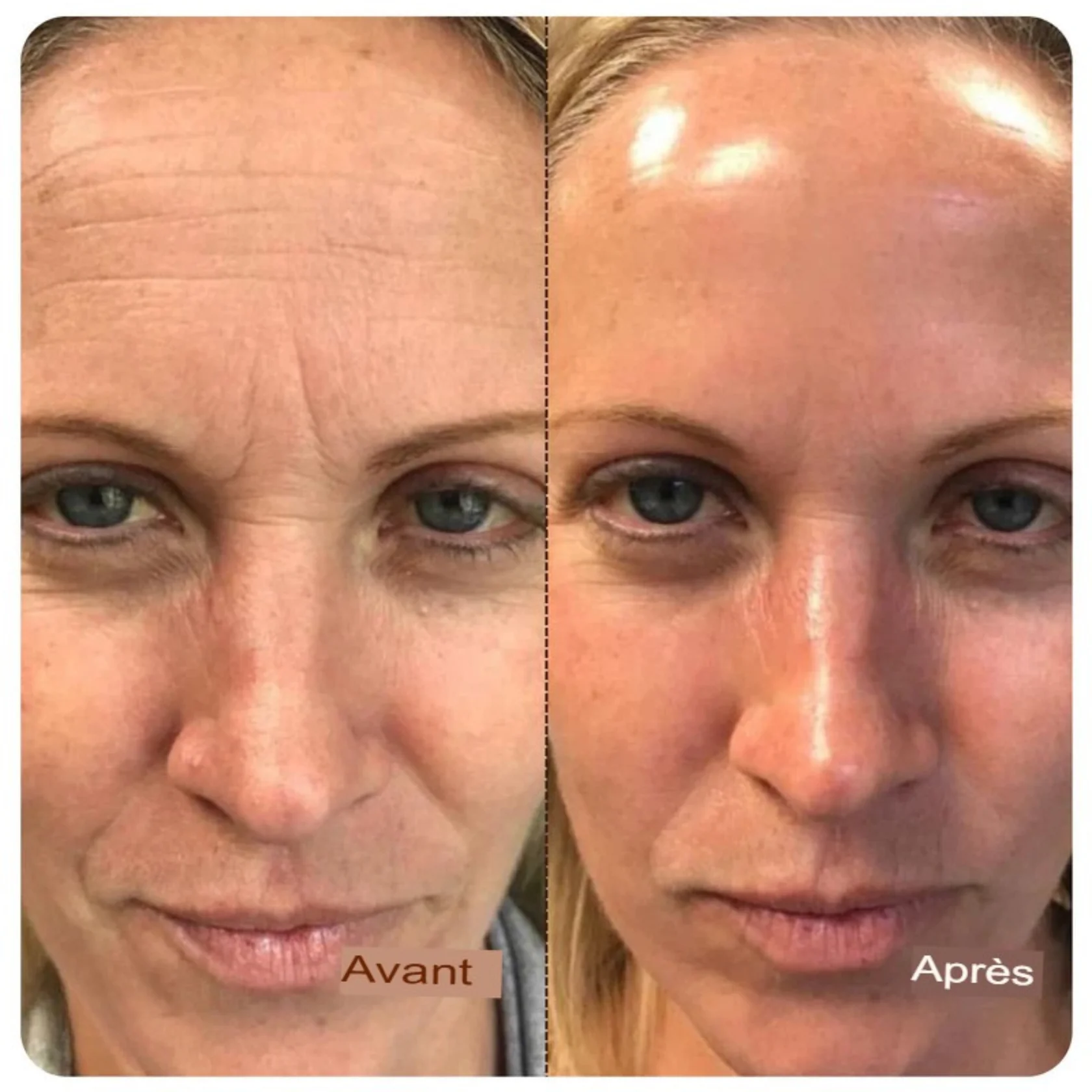 Ampoule liftante au collagène  aux peptides
