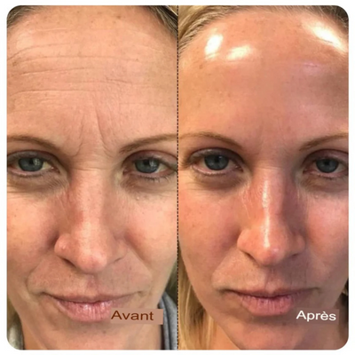 Ampoule liftante au collagène  aux peptides